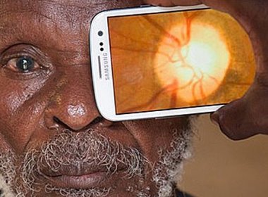 Aplicativo faz ‘exame de vista’ pelo celular; invento é testado na África