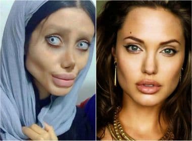 Iraniana faz mais de 50 plásticas para ficar parecida a Angelina Jolie; veja fotos
