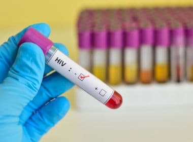 Governo federal raciona exame de carga viral para HIV
