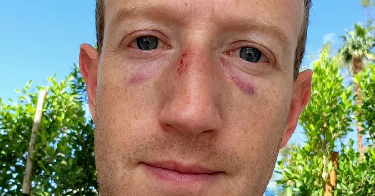 Após luta, Mark Zuckerberg posta foto com hematomas no rosto e brinca: “Saiu um pouco do controle”