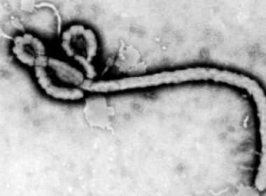França recebe funcionário da ONU com Ebola