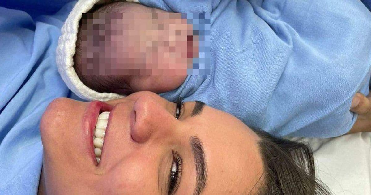 Bebê nasce empelicado e vídeo de médico rompendo bolsa viraliza; assista