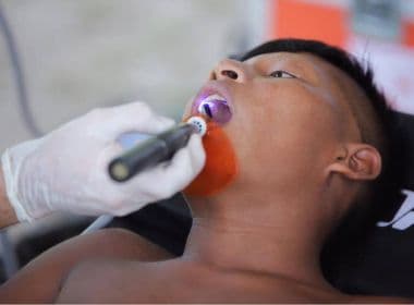 Índios isolados recebem próteses dentárias feitas com impressoras 3D