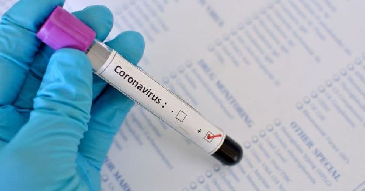 Total de testes para Covid-19 será ampliado para 22,9 milhões pelo Ministério da Saúde