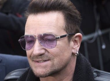 Cantor Bono passa por cirurgia após acidente
