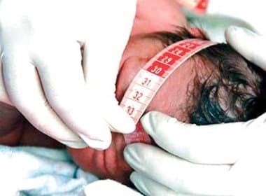 Juazeiro: Justiça obriga prefeitura e Estado a fornecer tratamento a bebê com microcefalia