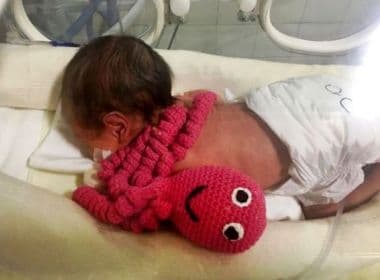 Porto Seguro: Polvos de crochê 'do amor' são utilizados na recuperação de bebês prematuros