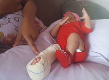 Ipiaú: Bebê sofre fratura no fêmur após cesárea; hospital alega ‘parto difícil’