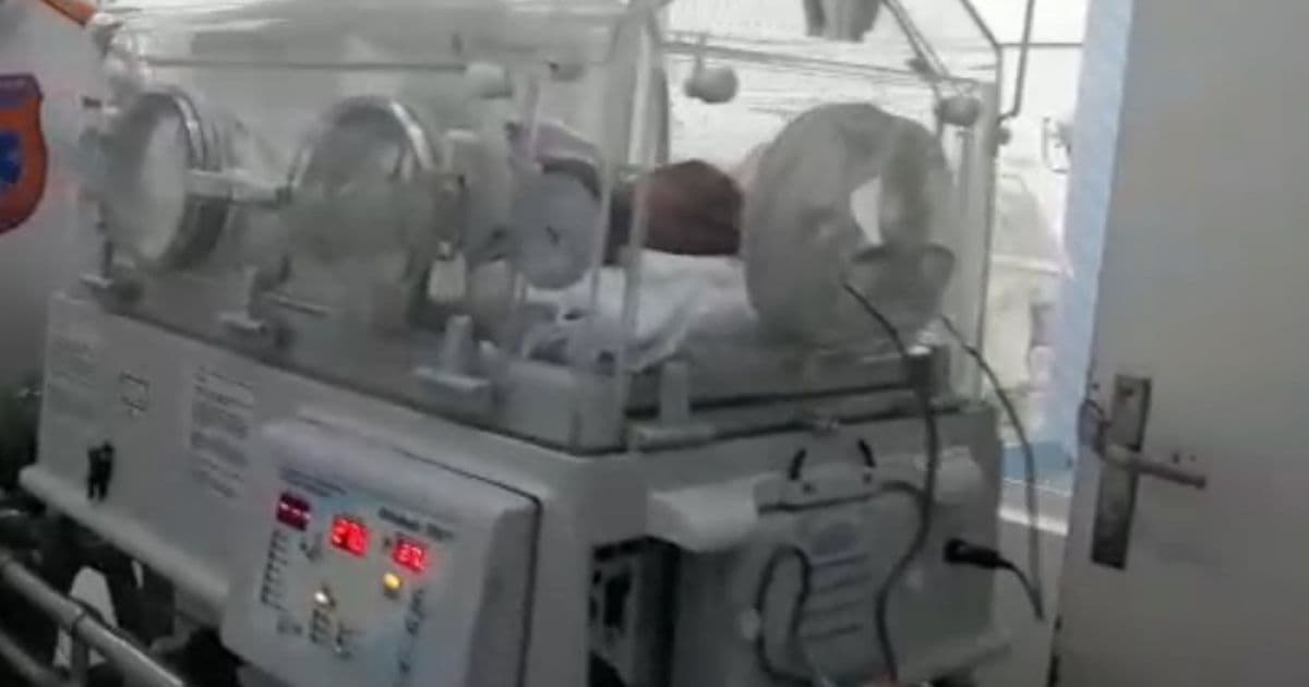 SAJ: Gêmeas siamesas são levadas para hospital referência em cirurgia de separação