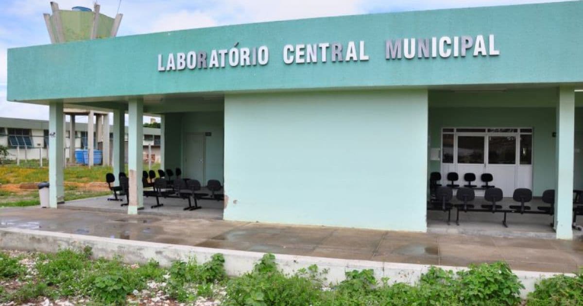 Vitória da Conquista: Laboratório Municipal realizará exames de coronavírus
