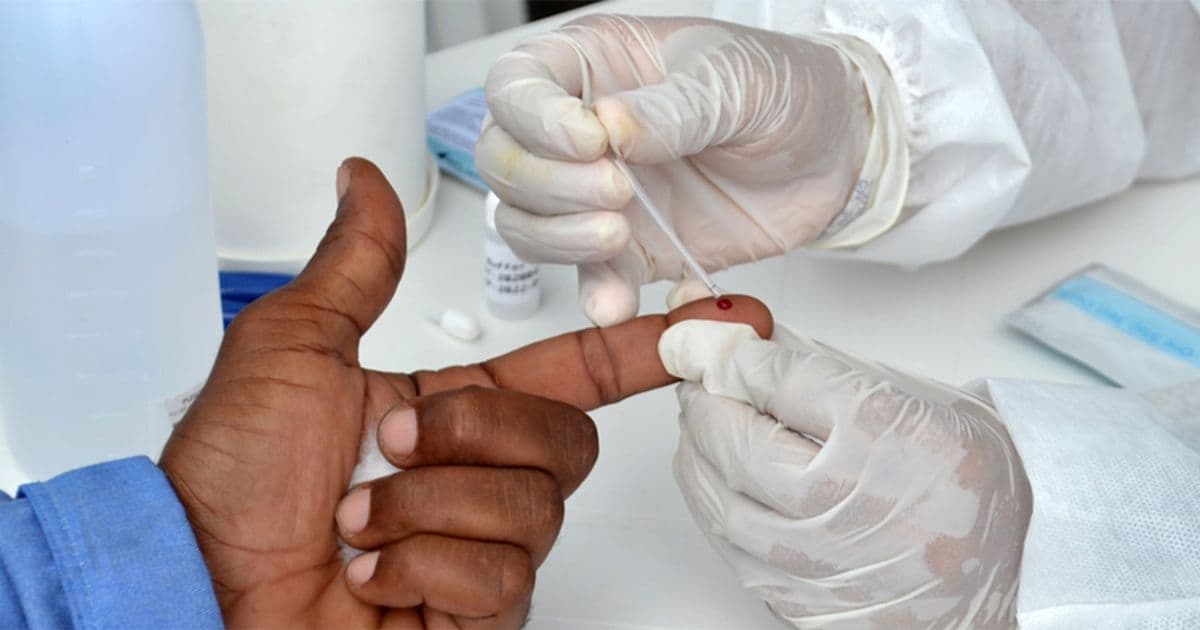 Feira de Santana: Quase 300 novos casos de HIV são registrados neste ano 