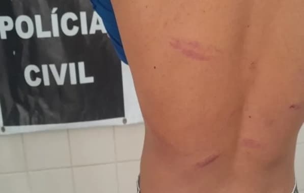 Estudante é agredido por colegas na Bahia; caso teria ocorrido após vítima curtir foto de colega