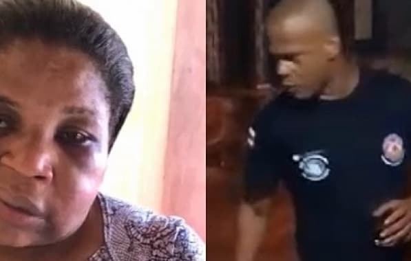 VÍDEO: Mulher agredida por PM no interior baiano aparece com rosto inchado 