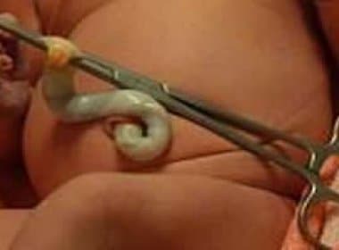 Bebê é abandonado com cordão umbilical em Mucuri