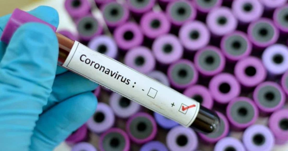 Com o coronavírus, é melhor prevenir do que remediar (literalmente)