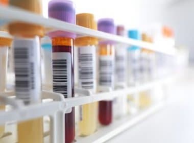 Japão desenvolve exame de sangue para detectar 11 tipos de câncer