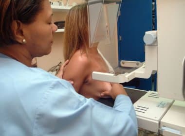 Secretaria fornece exames gratuitos de mamografia até final de setembro