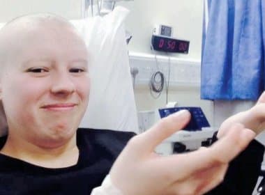 Jovem de 19 anos raspa cabelo e finge câncer para arrecadar dinheiro 