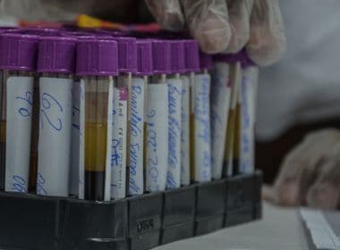 Testes rápidos detectam 15 casos de HIV nos circuitos;  foram feitos 1.428 exames