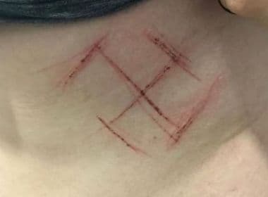Polícia apura ataque a mulher que teve suástica marcada no corpo com canivete no RS