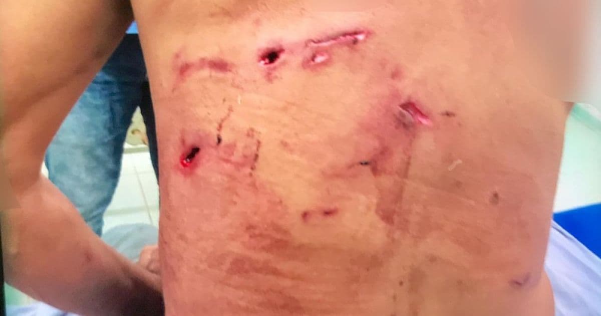 Homem atacado por onça-pintada é salvo por 5 cachorros em MS