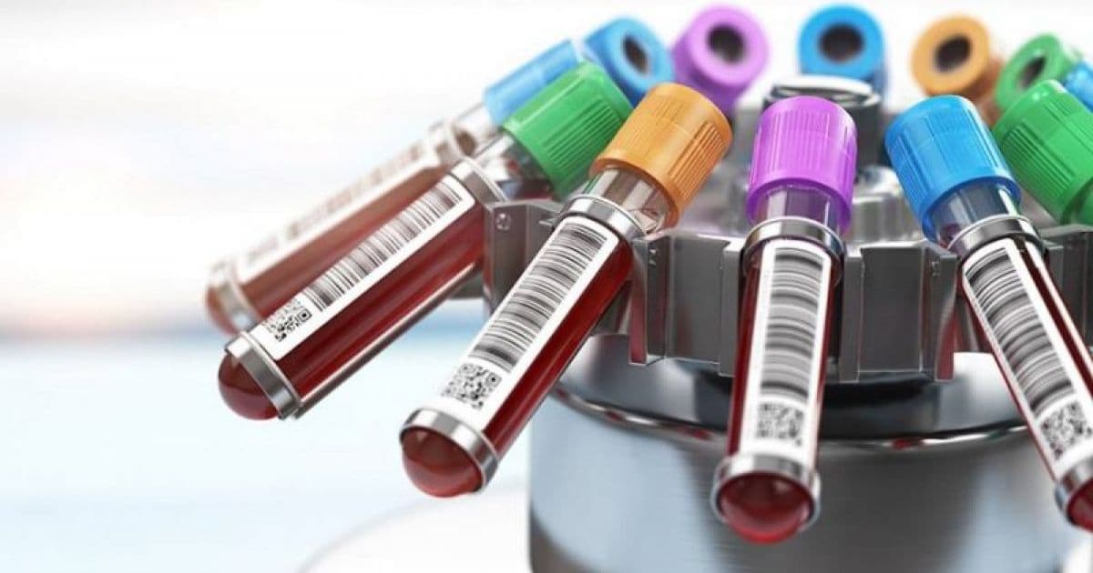 Estudo brasileiro dá início a testes com uso de plasma em pacientes com coronavírus