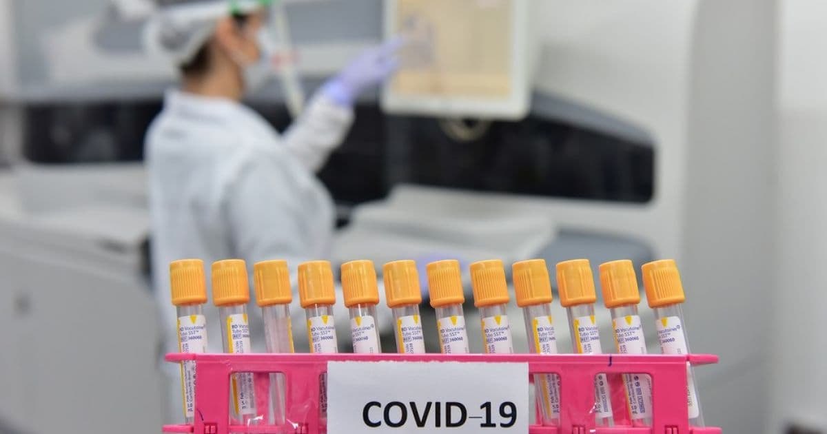 Reino Unido, EUA e Canadá acusam governo russo tentar roubar vacina contra Covid-19