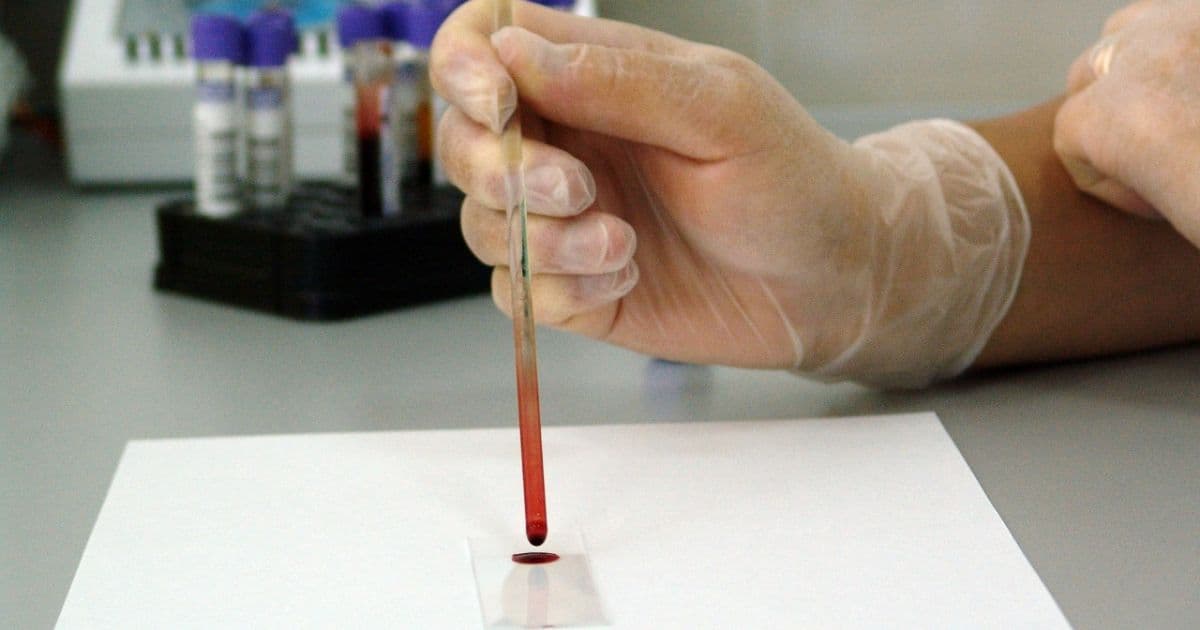 Viver Bem: Você sabia que muitos exames de sangue não exigem jejum?