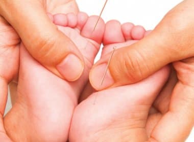 Pais podem recorrer à acupuntura para tratar doenças em bebês e crianças