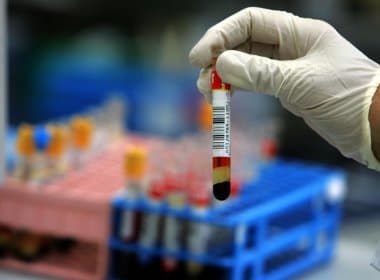 Hemoba registra aumento de mais de 30% no cadastro de doadores de medula