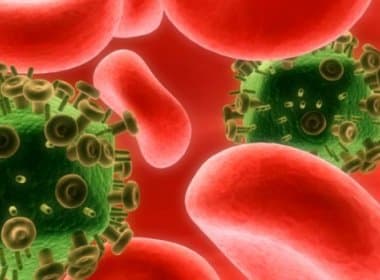 Cientistas afirmam ter feito vírus HIV desaparecer de organismo de 5 pessoas