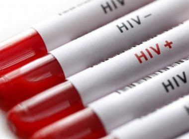 Células 'recauchutadas' conseguem destruir HIV, aponta estudo