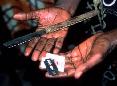 Consequências da mutilação genital afetam 200 milhões de mulheres no mundo, aponta ONU