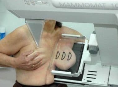 Bahia está em primeiro lugar no ranking de cobertura nacional de mamografia