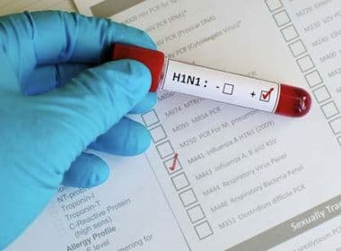 SMS confirma morte de criança por H1N1; caso é o 11º óbito na capital