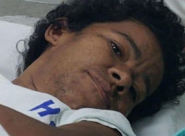 Hospital Roberto Santos procura familiares de paciente socorrida em Pernambués