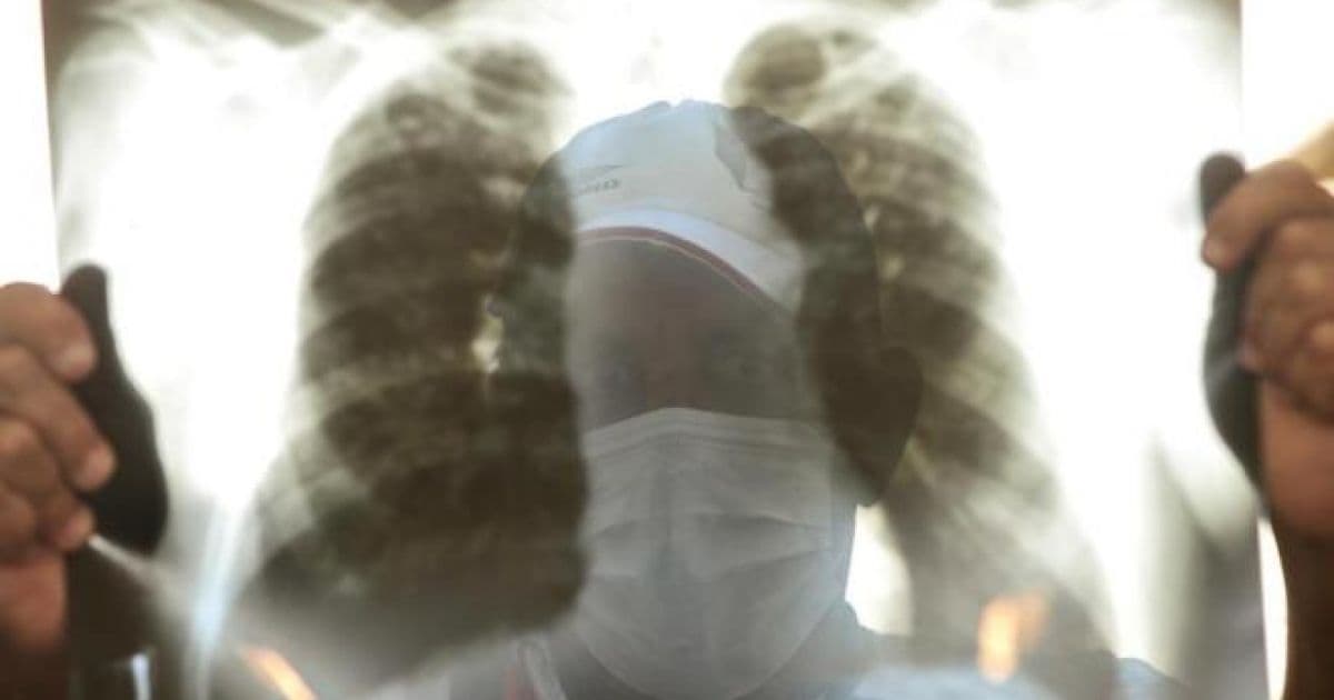 Mutirão de combate à tuberculose oferece consultas e exames gratuitos em São Cristóvão