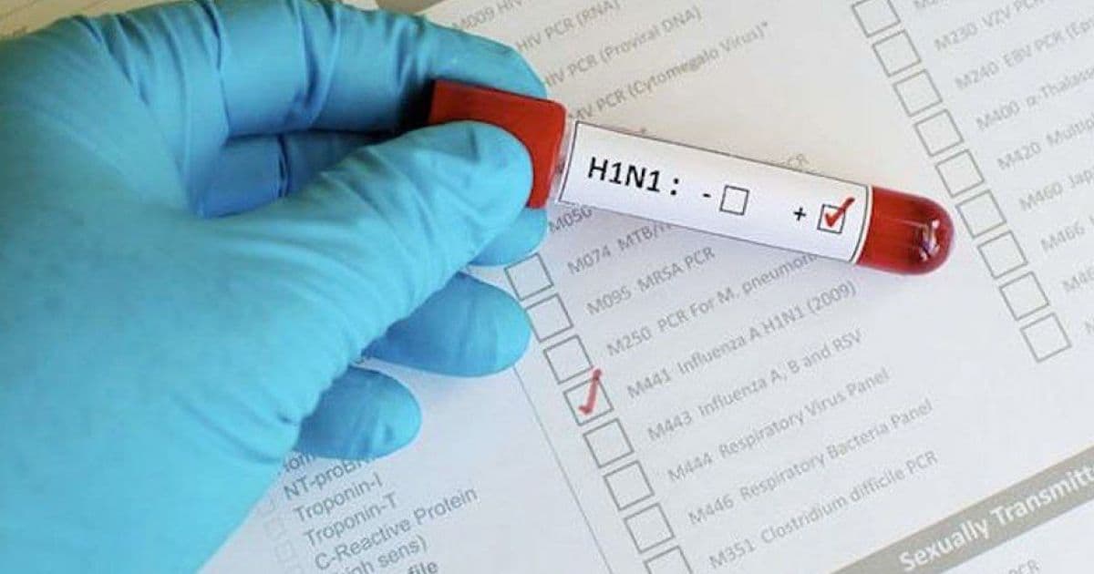Idoso de 69 anos morre por H1N1; caso é o 9º registrado em Salvador
