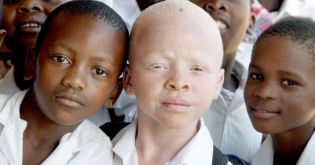 MP promove evento pelo Dia Mundial de Conscientização do Albinismo