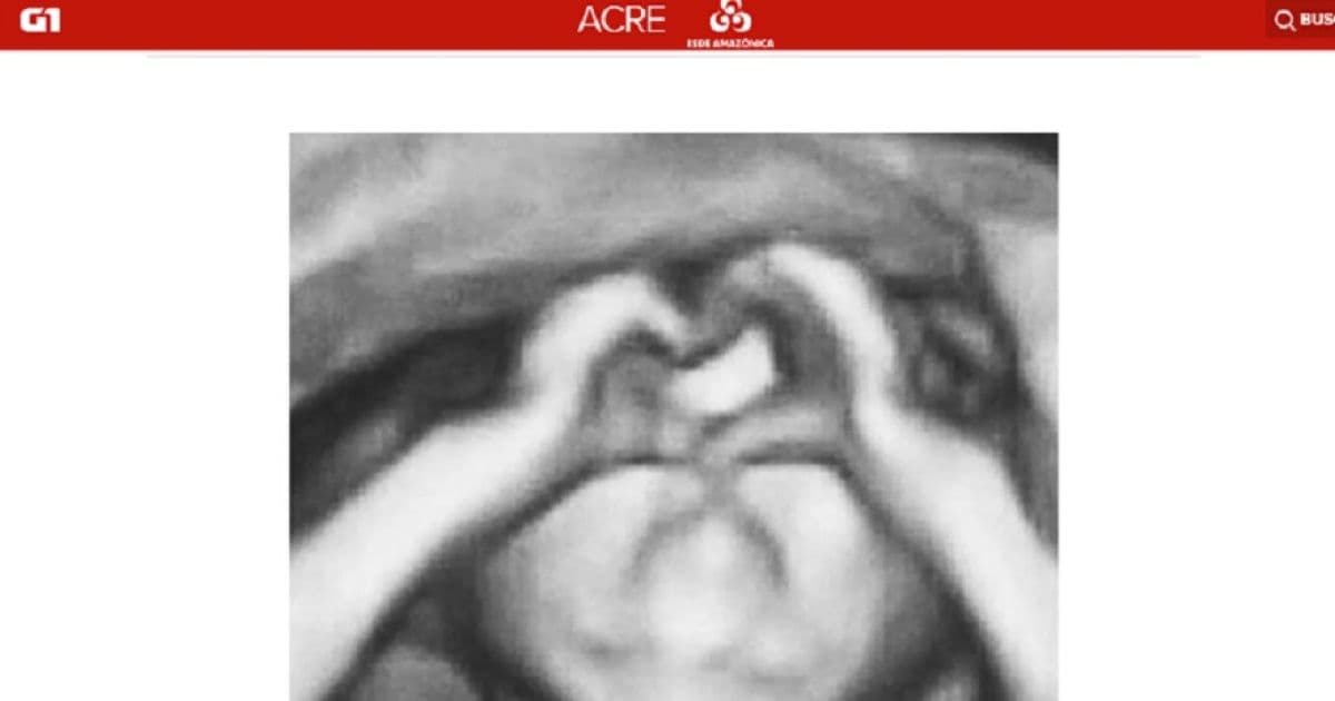 Ultrassom revela bebê fazendo coração com as mãos; mãe diz que imagem foi um presente