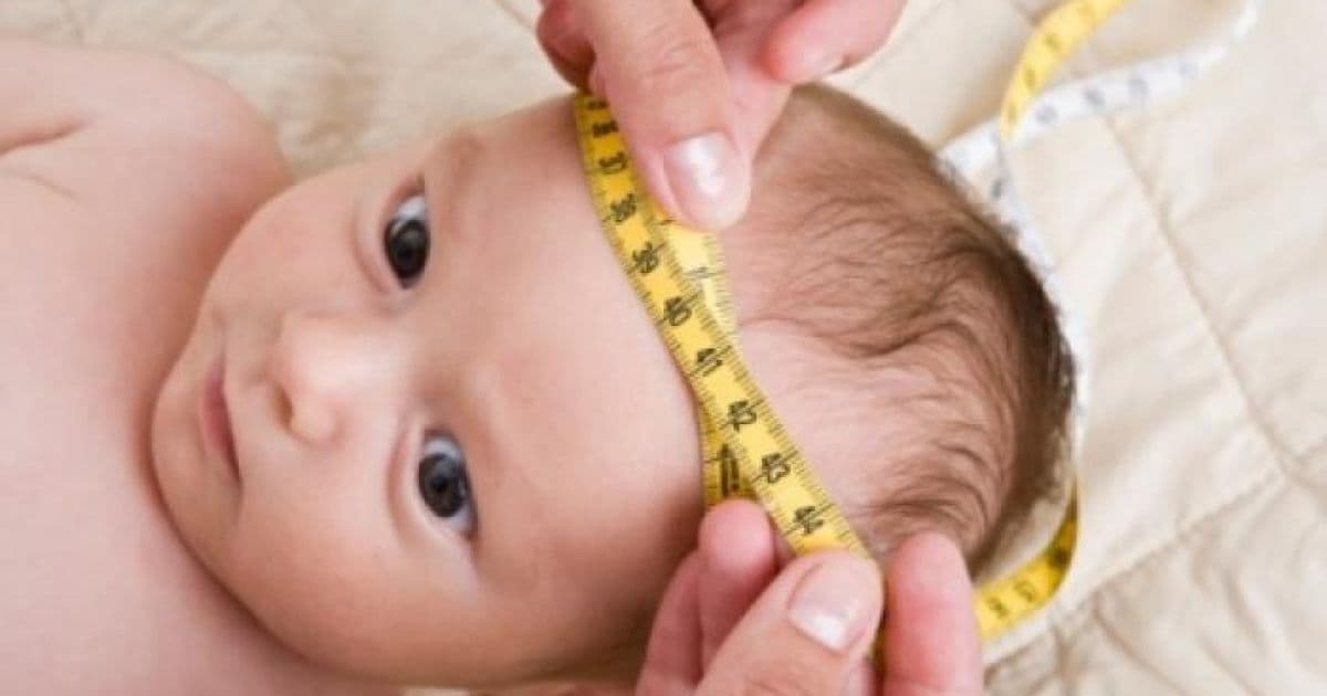 Estudo identifica 2 casos de reversão da microcefalia em bebês de mães com zika