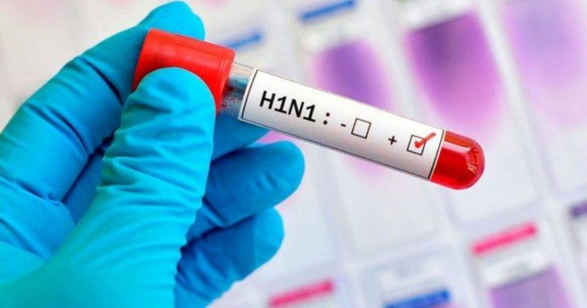 Quase metade das vítimas fatais de H1N1 na BA em 2019 não estava em faixa etária 'de risco'