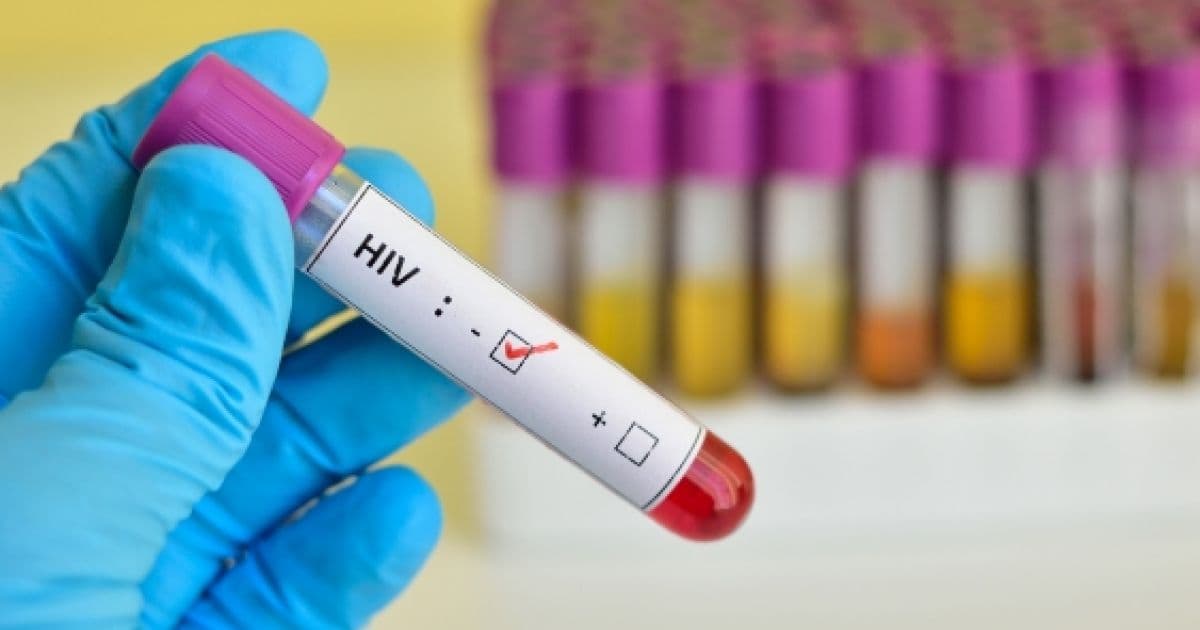 ONU estima que 1,7 milhão de pessoas foram infectadas pelo HIV em 2018