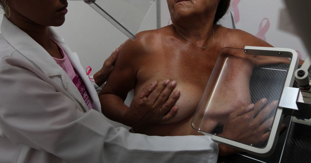 SBM defende ampliação de acesso a exames que diagnosticam câncer de mama