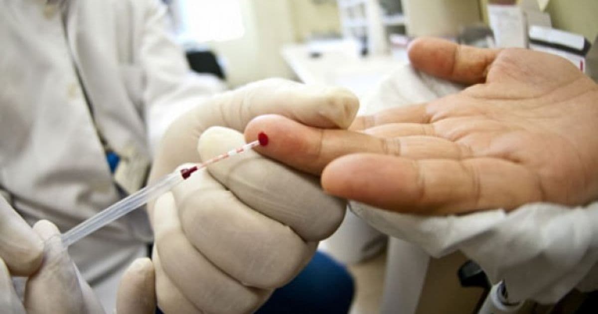 OMS faz recomendações de testagem para ampliar tratamento do HIV no mundo