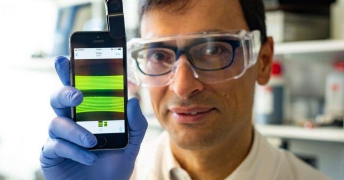 Cientistas criam tecnologia que identifica infecção urinária com uso de smartphone