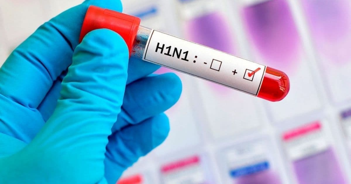 Suspeita de morte por H1N1 é investigada em Eunápolis, confirma Sesab
