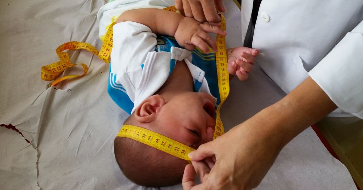 Governo Federal realiza mutirão de perícias com crianças com microcefalia em Salvador