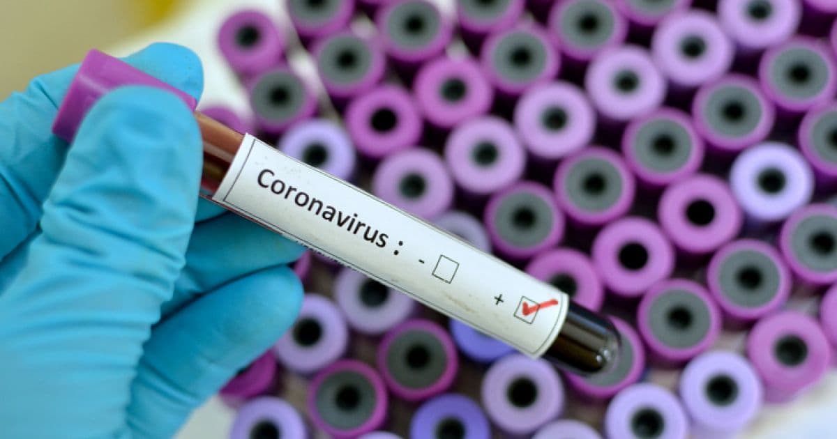 Cai para 8 número de casos suspeitos de coronavírus no Brasil