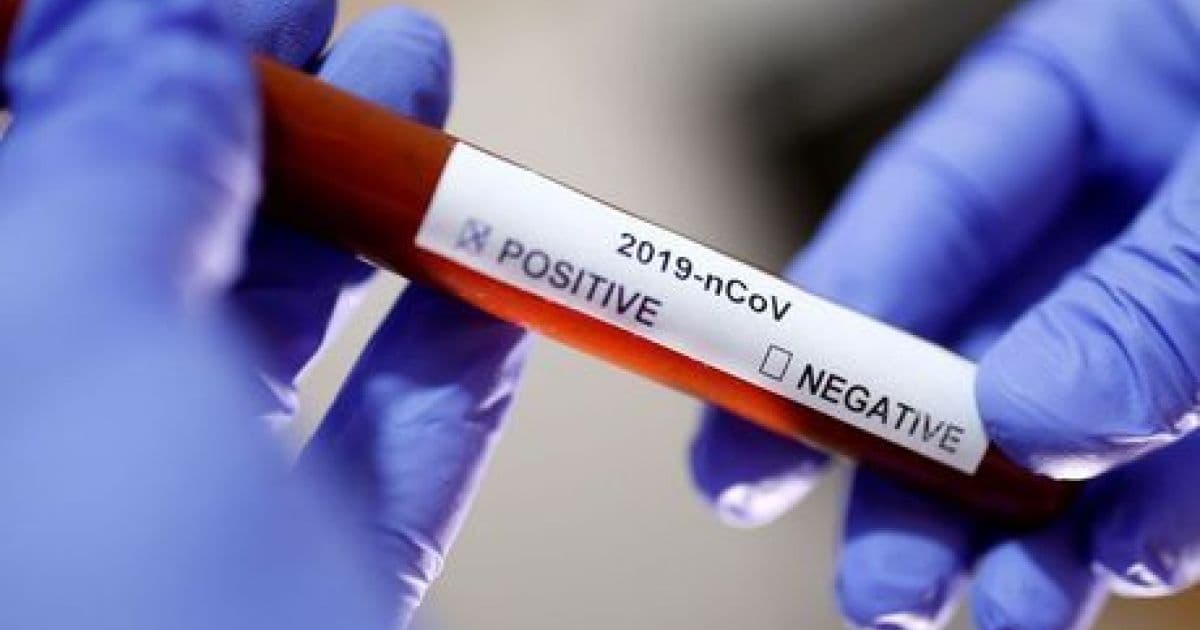 Brasil registra 77 mortes e 2.915 casos confirmados do novo coronavírus